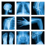 Medical X-Ray Interpretation 4.0.2 3